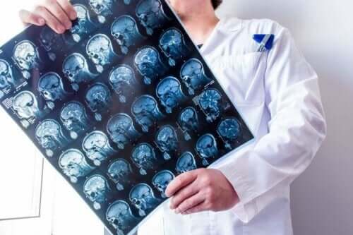 Arts met een scan van de hersenen