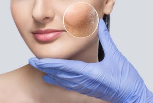 Dermatollog onderzoekt een huid