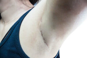 Wat is de schildwachtklier of poortwachterklier?