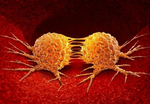 Een afbeelding van kankercellen