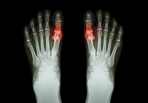Een röntgenfoto van twee voeten