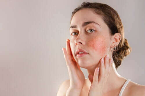 Alles wat je moet weten over een reactieve huid