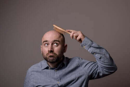 Alles over de verschillende soorten alopecia