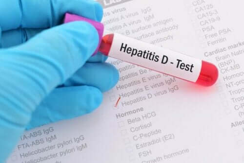 Bloedtest voor hepatitis d