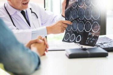 Neurogluten: gluten en neurologische aandoeningen