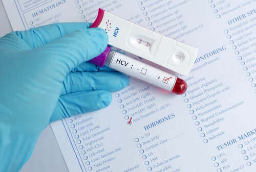 Hepatitis is te voorkomen