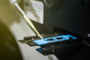 Hoe de resultaten van een spermogram te interpreteren