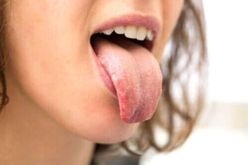 Waarom hebben mensen met diabetes een droge mond?