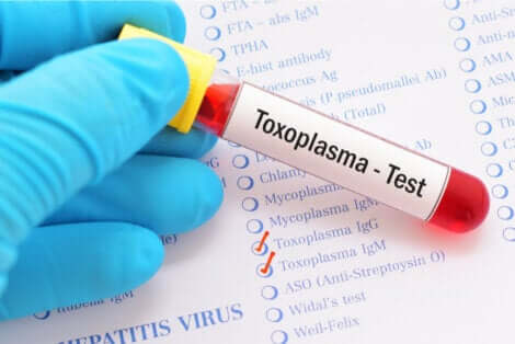 Een Toxoplasma-test