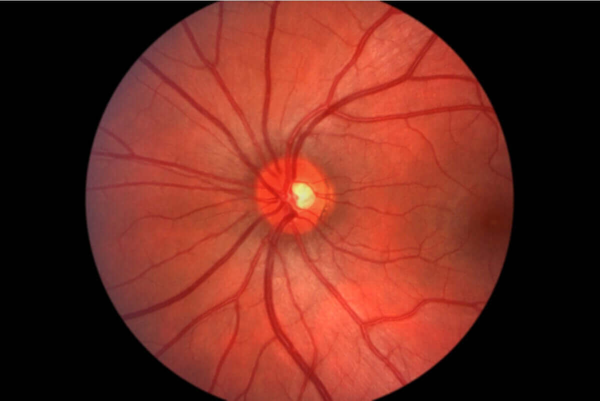 De fundus van het oog