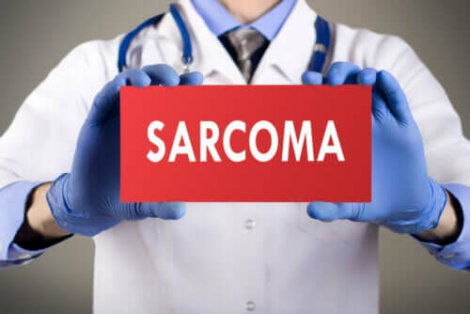 Verschillende soorten sarcomen en de kenmerken ervan