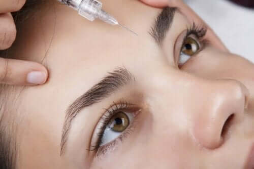 Botox tussen de wenkbrauwen