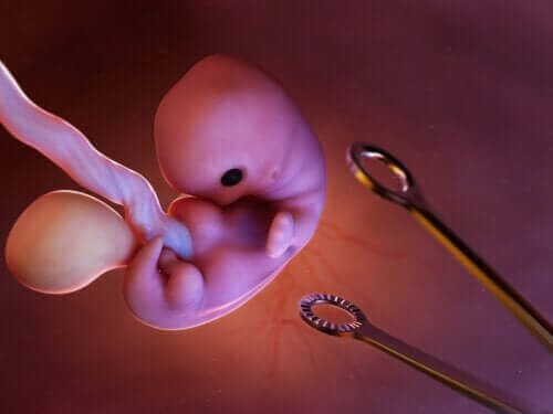 Wat is een geïnduceerde abortus?