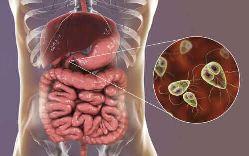 Giardia bij mensen behandeling - Parazitaellenes kezelési folyamat