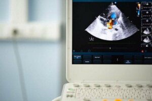 Een bicuspide aortaklep: diagnose en behandeling