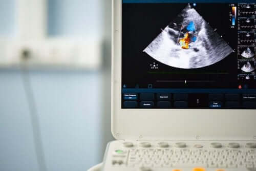 Een bicuspide aortaklep: diagnose en behandeling