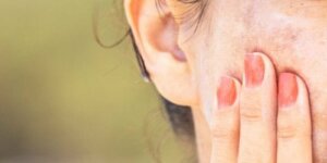 Natuurlijke remedies om donkere vlekken lichter te maken
