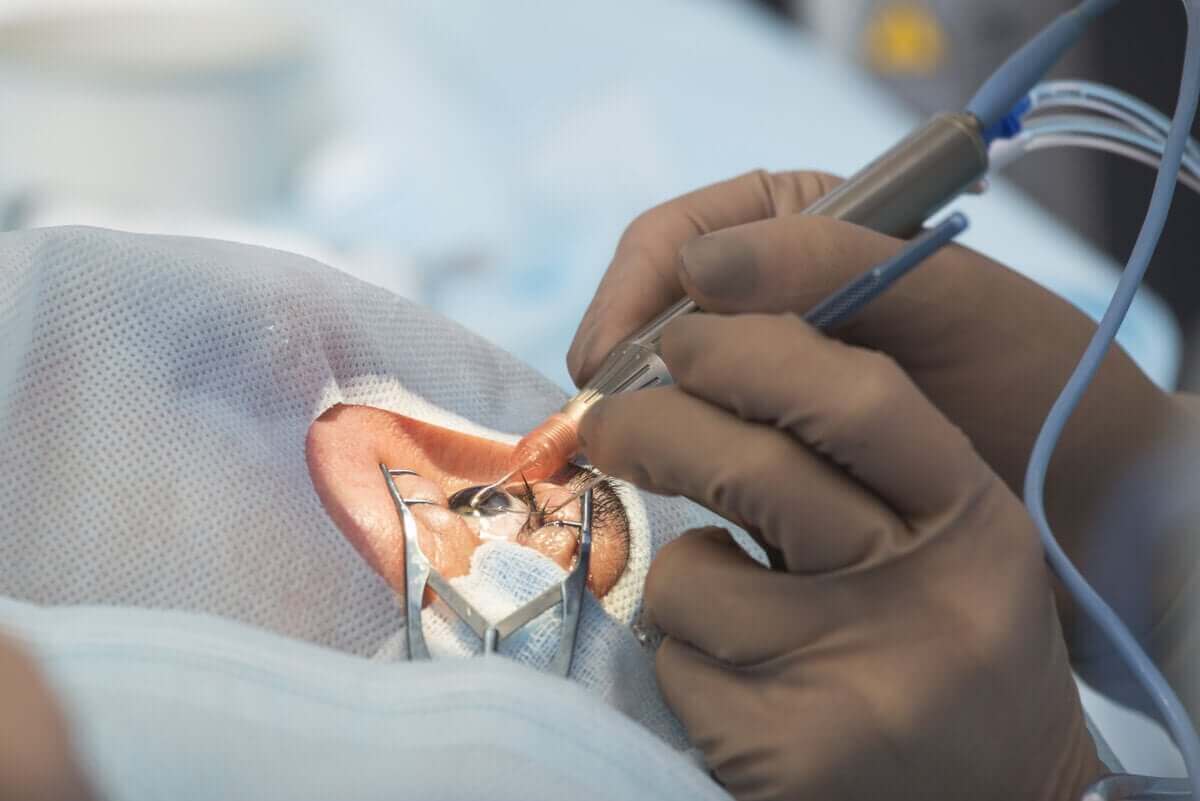 Iemand ondergaat een oogoperatie