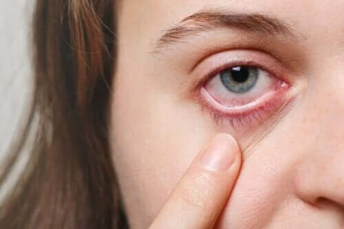 5 effectieve remedies voor ooginfecties