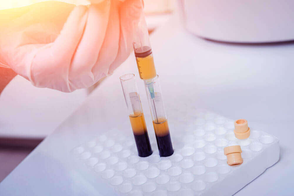 Het scheiden van bloed en plasma