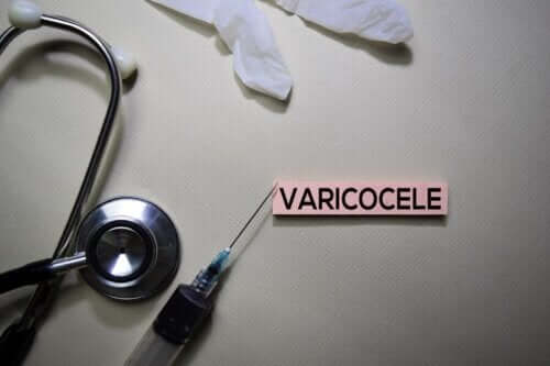 Wat je over varicocele moet weten