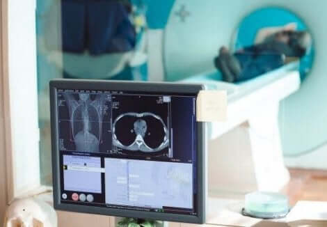 MRI en beeldscherm