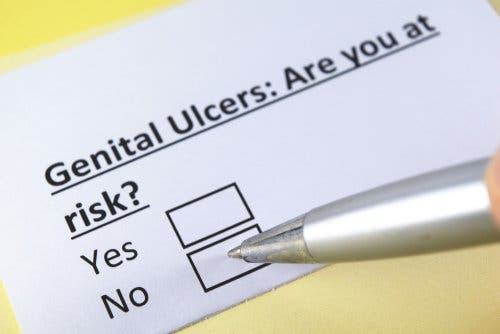 Vraag over of iemand risico op zweren loopt