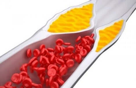 Wat is cholesterol