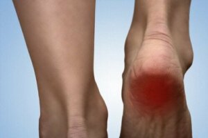 Ontdek 5 remedies voor hielspoor