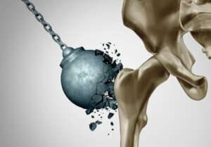 Schade van osteoporose na de menopauze beperken