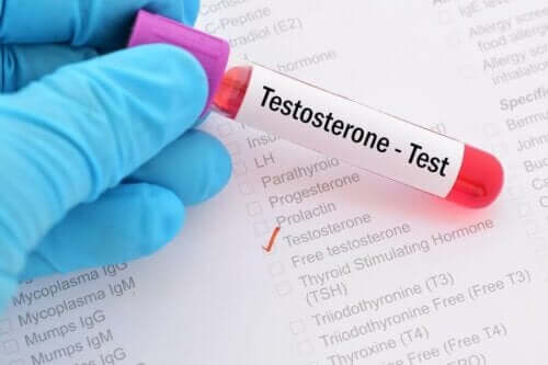Wat is het testosterondeficiëntiesyndroom?
