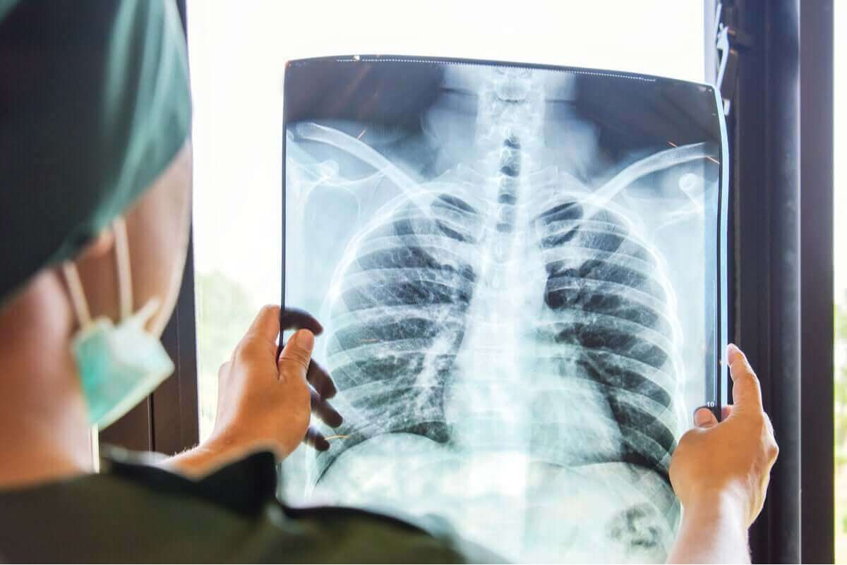 Röntgen van de longen