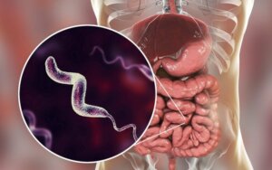 Campylobacter-infecties: alles wat je moet weten