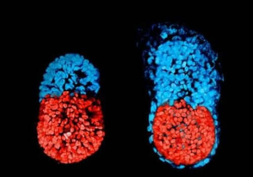 Embryo met verkeerde ontwikkeling