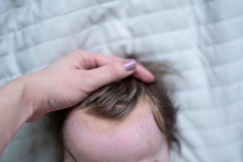6 dingen die je moet weten over berg bij baby's