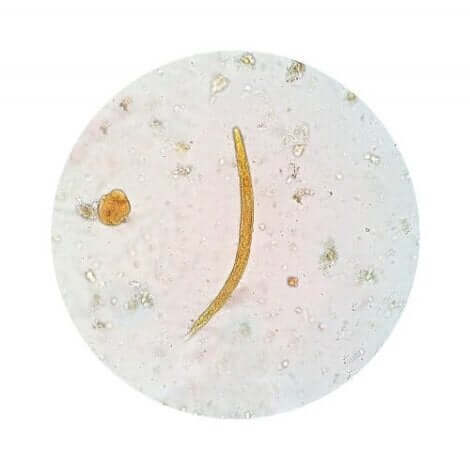 Een afbeelding van een parasiet onder een vergrootglas