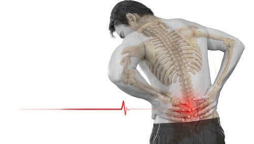 Wat is spondylolisthesis en wat zijn de symptomen