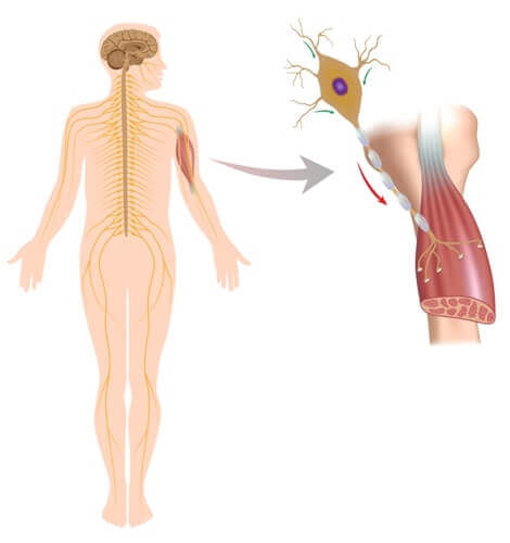 Effect van een neuromusculaire aandoening