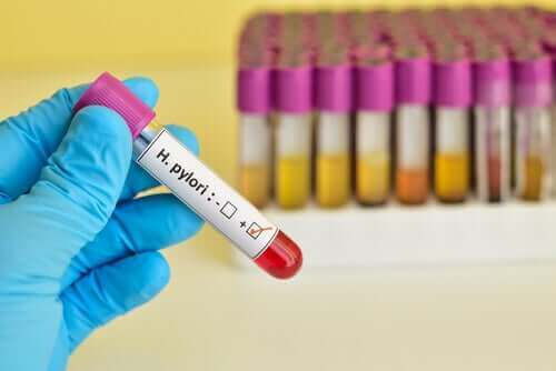Een positieve H. pylori-test