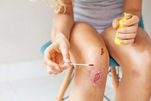 Een kanpotte knie met betadine behandelen