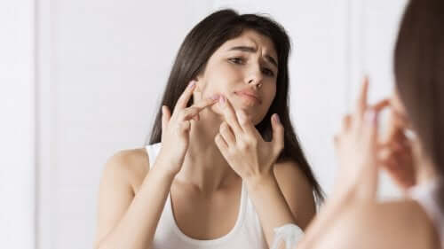 Vrouw met acne