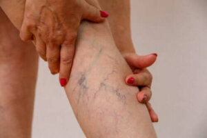Beschrijving, symptomen en behandeling van flebitis