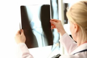 Voeding rijk aan calcium en vitamine D voor gezonde botten