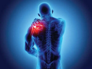 Spondyloarthropathieën: symptomen en diagnose