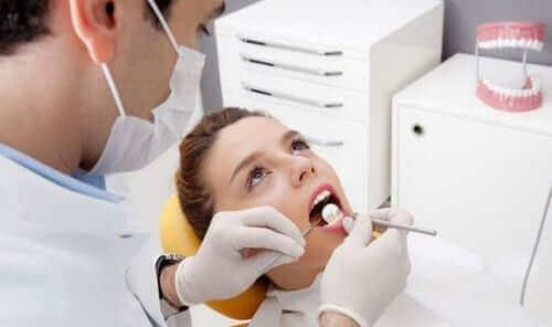 Alleen tandarts kan tandsteen verwijderen