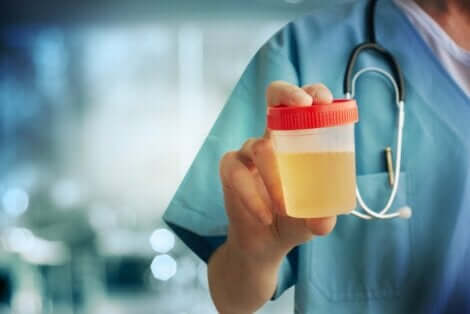 Arts die een urinemonster vasthoudt