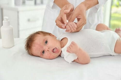 Oorzaken en behandeling van baby-acne