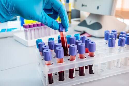 Bloed voor bloedonderzoek