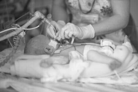 Een baby met neonatale ademhalingsproblemen