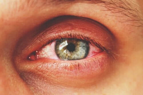 Iemand met een rood oog